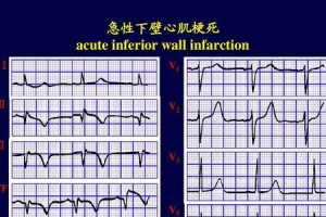 CV1-8B128（揭开CV1-8B128的神秘面纱，探索其无限可能性）